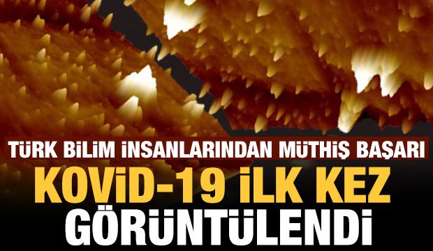 Koronavirüs, Türk bilim insanları tarafından yerli süper mikroskopla görüntülendi