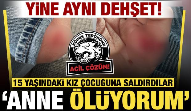 Ankara’da sokak köpeklerinden 15 yaşındaki kız çocuğuna saldırı