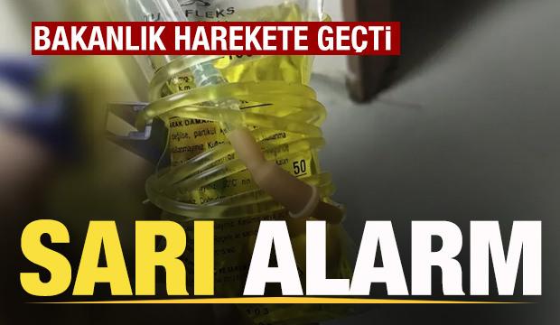 Sarı alarm! (Gazete manşetleri)