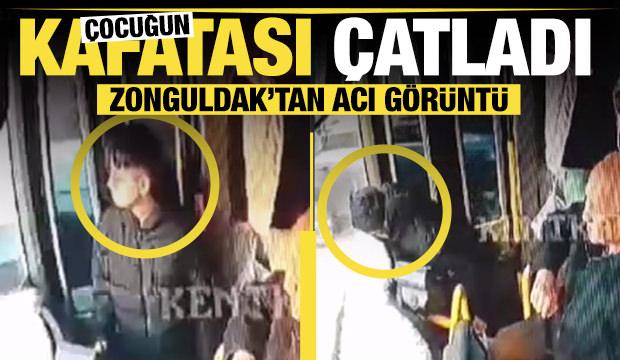 Zonguldak'ta acı görüntü... Çocuğun kafatası çatladı