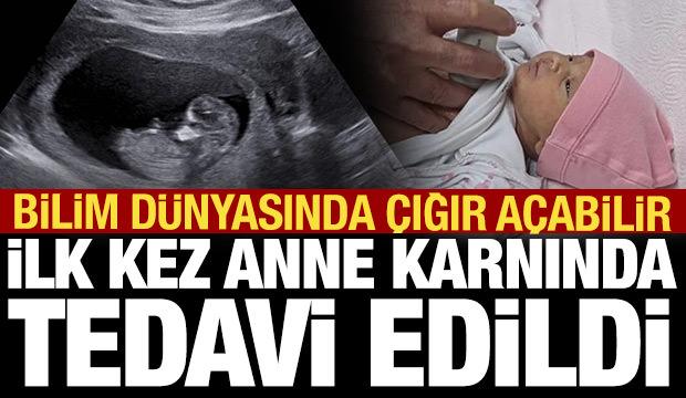 SMA ilk kez anne karnında tedavi edildi