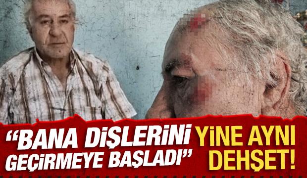 Burdur'da başıboş sokak köpeklerinin saldırdığı kişi yaralandı