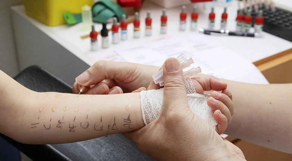 Çocuklarda alerji testi nasıl yapılır? Deri prick testi nedir?