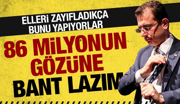 86 milyonun gözüne bant lazım