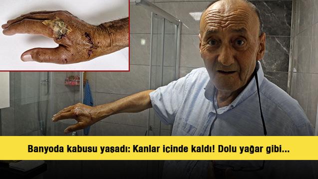 Banyoda kabusu yaşadı: Kanlar içinde kaldı! Dolu yağar gibi...