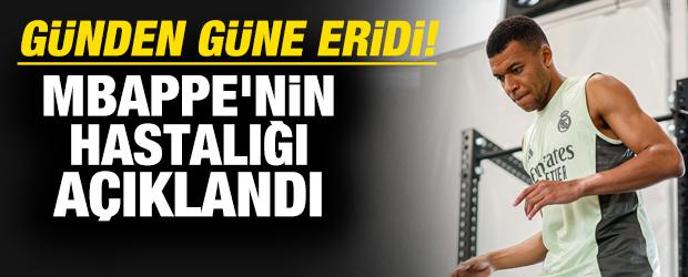 Günden güne eridi! Mbappe'nin hastalığı açıklandı