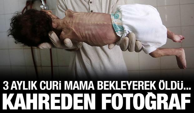 İsrail ablukası altındaki Gazze'de 3 aylık bebek Curi de açlıktan öldü