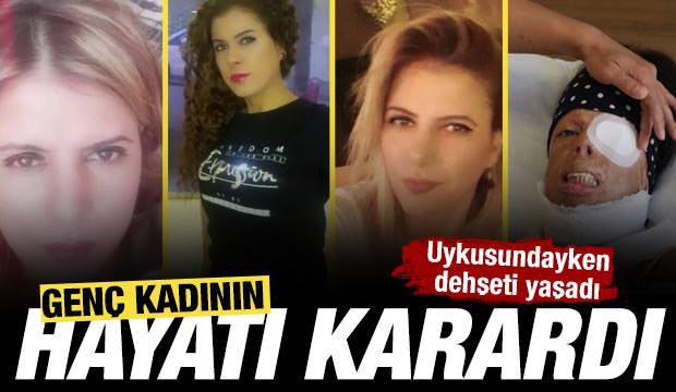 Uykusundayken eski sevgilisi yüzüne kezzap attı! Genç kadının hayatı karardı