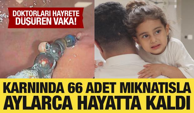 Doktorları bile şoke eden vaka: Karnında 66 adet mıknatısla aylarca hayatta kaldı