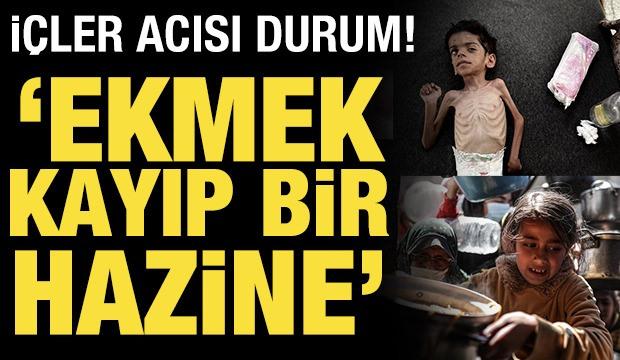 Gazze'deki acı gerçek: İnsanlar açlıktan teker teker düşüyor!