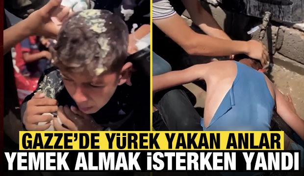 Gazze'de yürek yakan anlar yemek almak isterken yandı!