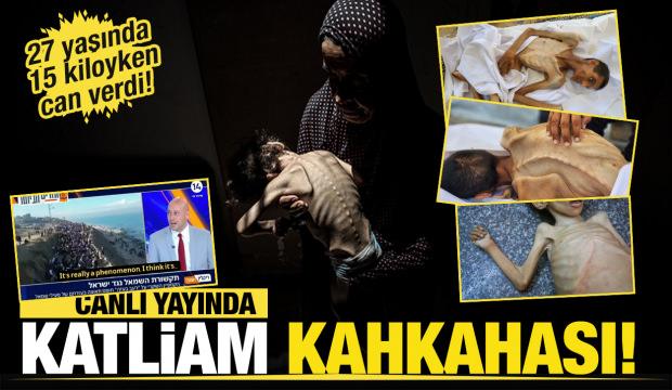 Katliam kahkahası! İsrail Gazze'de kıtlığı dayatıyor! 27 yaşında 15 kiloyken can verdi!