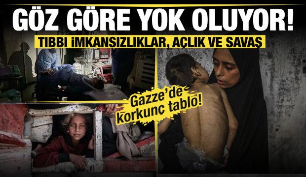 Tıbbı imkansızlıklar, açlık ve savaş... Gazze göz göre göre yok oluyor!