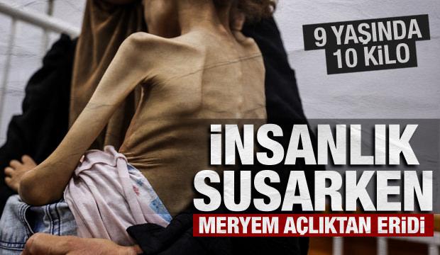 Gazze'de açlık krizi büyüyor! 9 yaşındaki Meryem 10 kiloya düştü