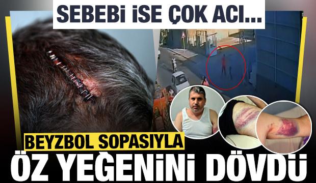 Miras anlaşmazlığında yeğenini beyzbol sopasıyla darbetti! 