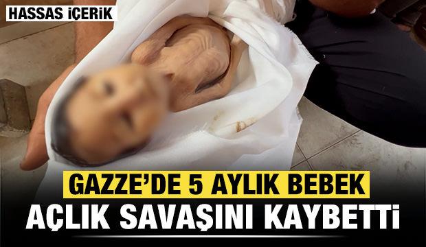 Gazze'de 5 aylık bebek açlığa yenik düştü