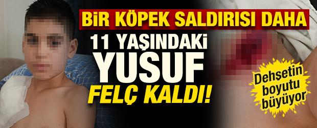 Köpek tarafından parçalanmıştı! Yunus'un sağ kolu felç kaldı