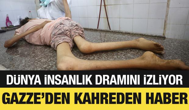 Gazze'den kahreden haber: Bir günde 339 kişi şehit düştü