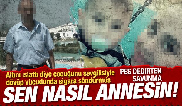 Altını ıslattığı için 3,5 yaşındaki çocuğu dövüp, vücudunda sigara söndürmüşler