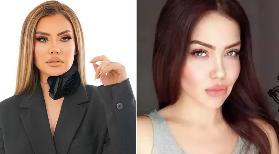 Beyninde kitle belirlenen Lara'dan ilginç itiraf: Rüyamda gördüm!