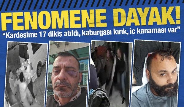 Sosyal medya fenomeni boşanma aşamasındaki eşi ve ailesi tarafından darbedildi