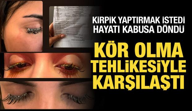 Kirpik yaptırmak isteyen kadının hayatı kabusa döndü: Kör olacaktı!