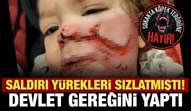 Ankara'da iki kardeşe saldıran köpeğin sahibi tutuklandı