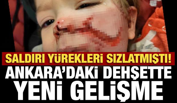 Ankara'da iki kardeşe saldıran pitbull ve sahibi yakalandı