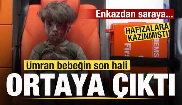 Dünya gündemine oturmuştu! Ümran bebeğin son hali ortaya çıktı!