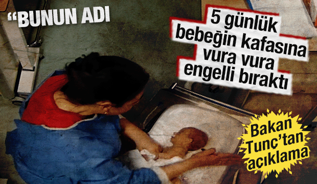 5 g&uuml;nl&uuml;k bebeğe hemşire şiddeti kamerada: Aile ger&ccedil;eği 3 yıl sonra &ouml;ğrendi