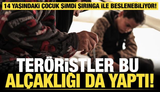 Gazze'de y&uuml;rek burkan dram: Annesi yaralı oğlunu şırıngayla besliyor