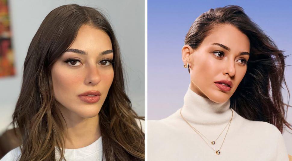 Dilan &Ccedil;i&ccedil;ek Deniz'in y&uuml;z&uuml;ndeki değişim olay oldu! G&ouml;renler tanıyamadı