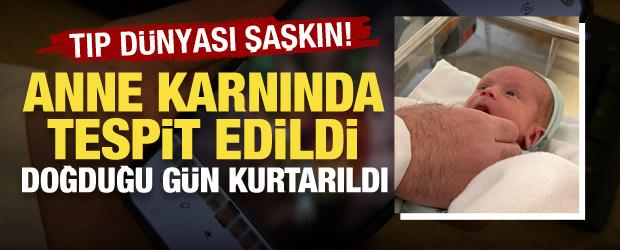 Tıp d&uuml;nyasını şaşırtan vaka! Anne karnında tespit edildi, doğduğu g&uuml;n kurtarıldı