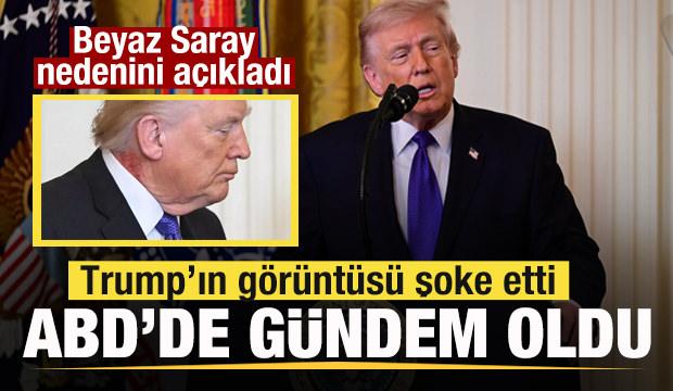 Trump'ın g&ouml;r&uuml;nt&uuml;s&uuml; şoke etti! ABD'de g&uuml;ndem oldu! Beyaz Saray nedenini a&ccedil;ıkladı
