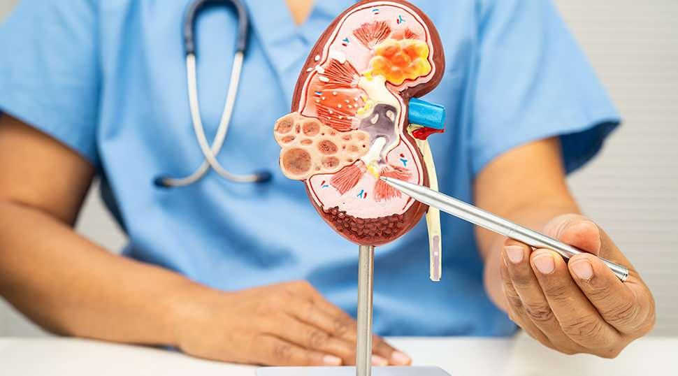 &Ccedil;ocuklarda b&ouml;brek hastalığının ilk sinyali ateş