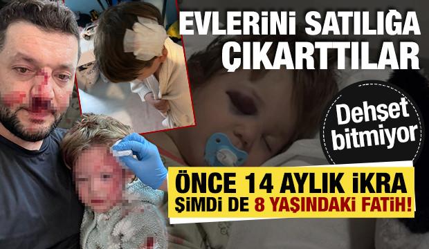 Yalova'da baba ile 14 aylık bebek darbedilmişti! Ailenin 8 yaşındaki &ccedil;ocuğu taşlandı