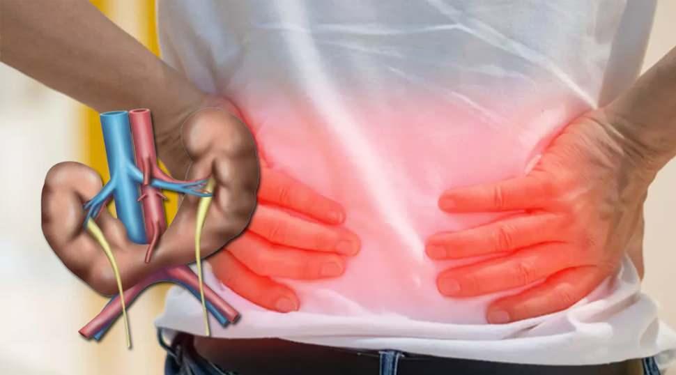 At nalı b&ouml;brek: Her 400 doğumda g&ouml;r&uuml;len belirti vermeyen b&ouml;brek anomalisi ve riskleri