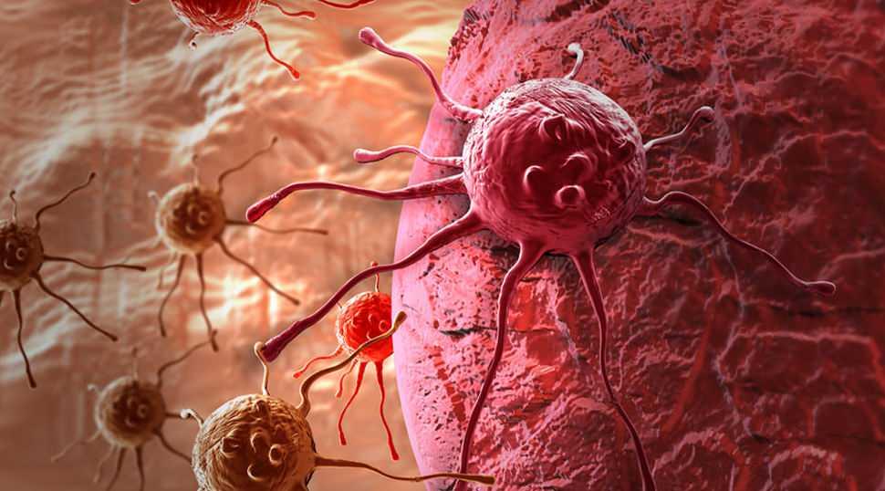 V&uuml;cudunuzun sessiz uyarıları: Kanser &ouml;ncesi belirtileri g&ouml;z ardı etmeyin!