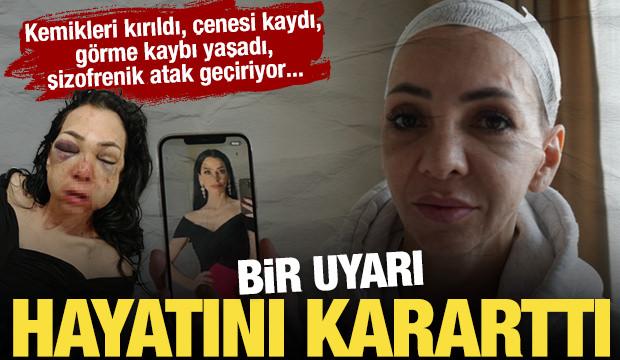 Y&uuml;z&uuml; par&ccedil;alanan annenin hukuk m&uuml;cadelesi: Hem darbedildi hem tehdit ediliyor