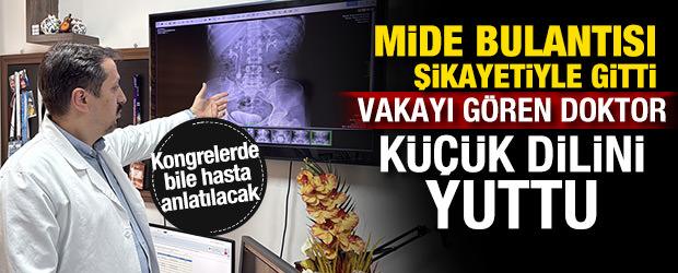 İdrar kanalından &ccedil;ıkan taşlar doktor, hasta ve yakınlarını şaşırttı