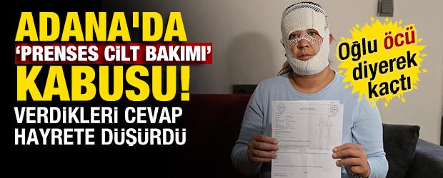 Adana'da "prenses cilt bakımı" kabusu! 2 yaşındaki oğlu "&ouml;c&uuml;" diyerek ka&ccedil;tı 