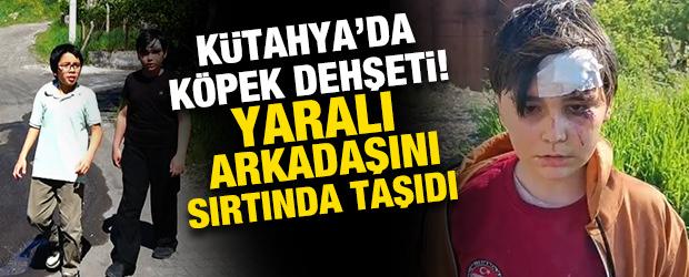 K&uuml;tahya'da başıboş k&ouml;pek dehşeti! 2 &ccedil;ocuk saldırıya uğradı