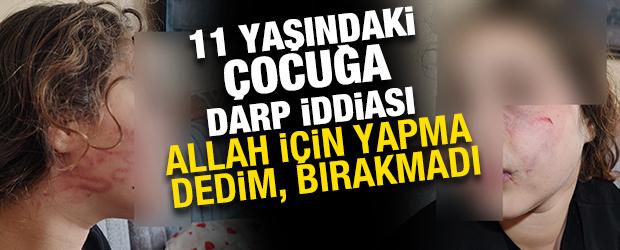 Adana'da 11 yaşındaki &ccedil;ocuğa darp iddiası! Allah i&ccedil;in yapma dedim