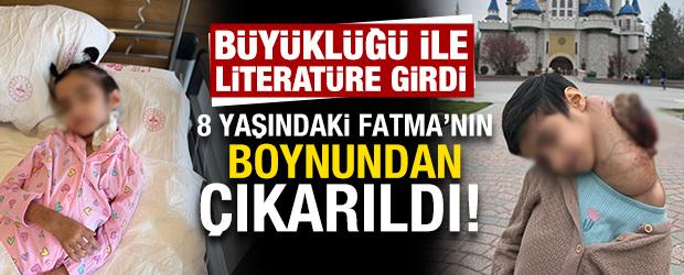 8 yaşındaki Fatma&rsquo;nın boynundan &ccedil;ıkarıldı! B&uuml;y&uuml;kl&uuml;ğ&uuml; ile literat&uuml;re girdi