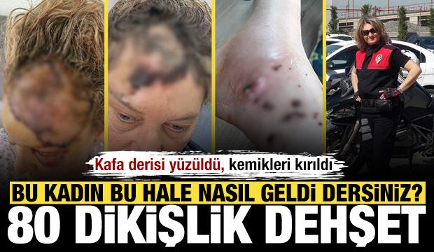 V&uuml;cuduna 80 dikiş atıldı: Patronunun k&ouml;peği tarafından par&ccedil;alanan koruma isyan etti