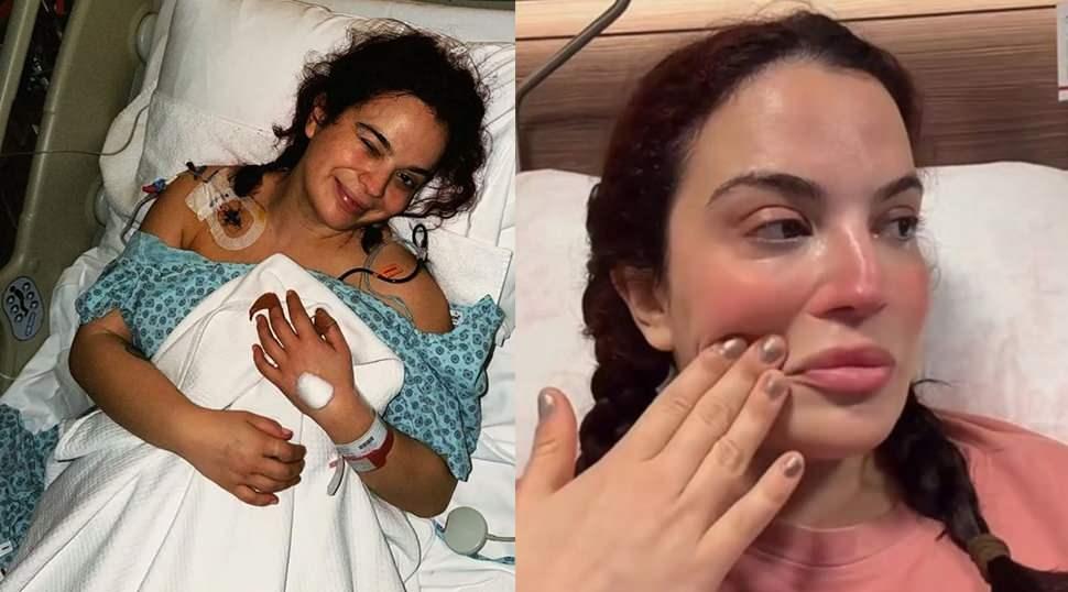 7. kez ameliyat masasına yatmıştı! Aslı Bekiroğlu: Bedenim deforme olduğu i&ccedil;in mutsuzum