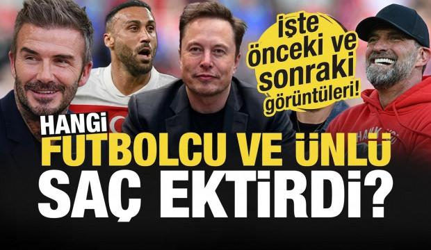 Hangi futbolcular ve &uuml;nl&uuml;ler sa&ccedil; ektirdi? &Ouml;nceki ve sonraki g&ouml;r&uuml;nt&uuml;leri şaşkına &ccedil;evirdi