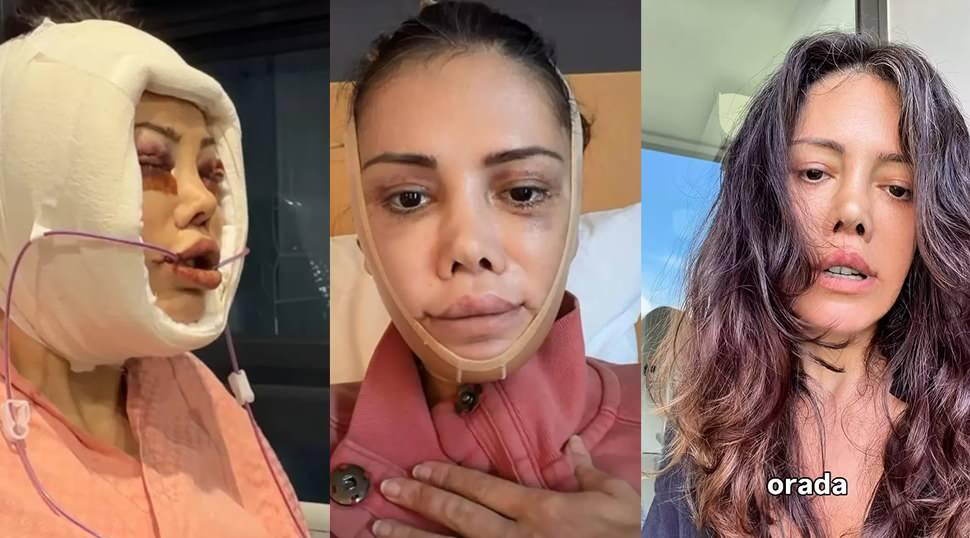 Y&uuml;z nakli ge&ccedil;iren Didem Ceran ateş p&uuml;sk&uuml;rd&uuml;: 'İnsanlar neden yaraya tuz basar?'