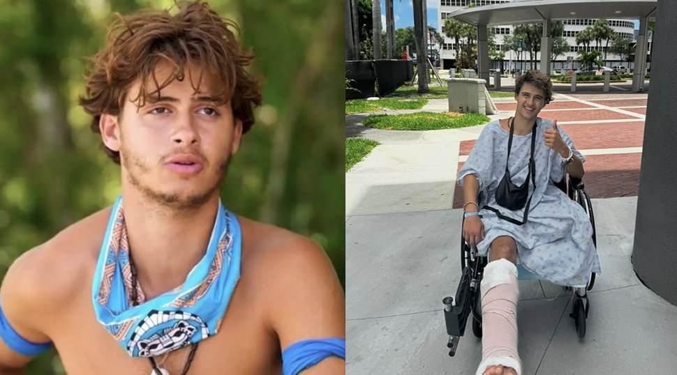 Bacağı ampute edilmişti! Survivor yarışmacısının son hali ortaya &ccedil;ıktı