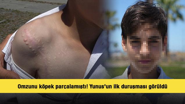 Omzunu k&ouml;pek par&ccedil;alamıştı! Yunus'un ilk duruşması g&ouml;r&uuml;ld&uuml;
